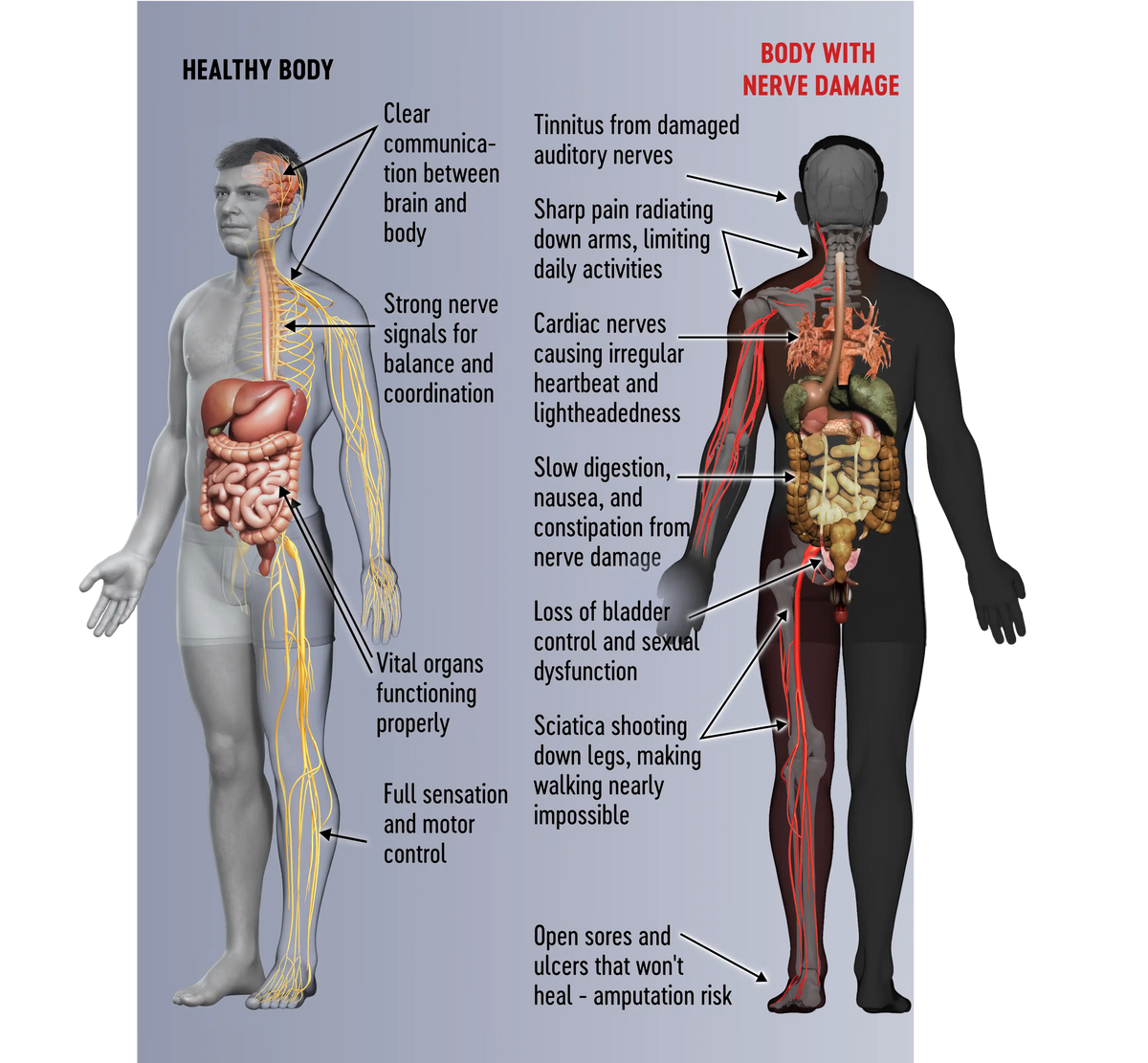 Nerve Damage: The hidden time bomb destroying your independence